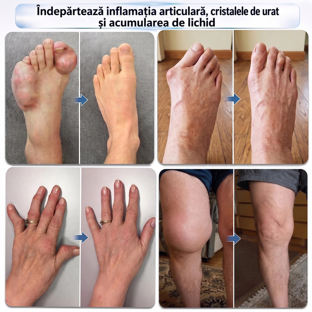 🌿𝑿𝑹𝑳𝑿𝑹𝑳®👨‍⚕️ TEHNOLOGIE ORTOPEDICĂ DE NOUĂ GENERAȚIE Rulou regenerant pentru oase și articulații cu microace de 0,05 mm
