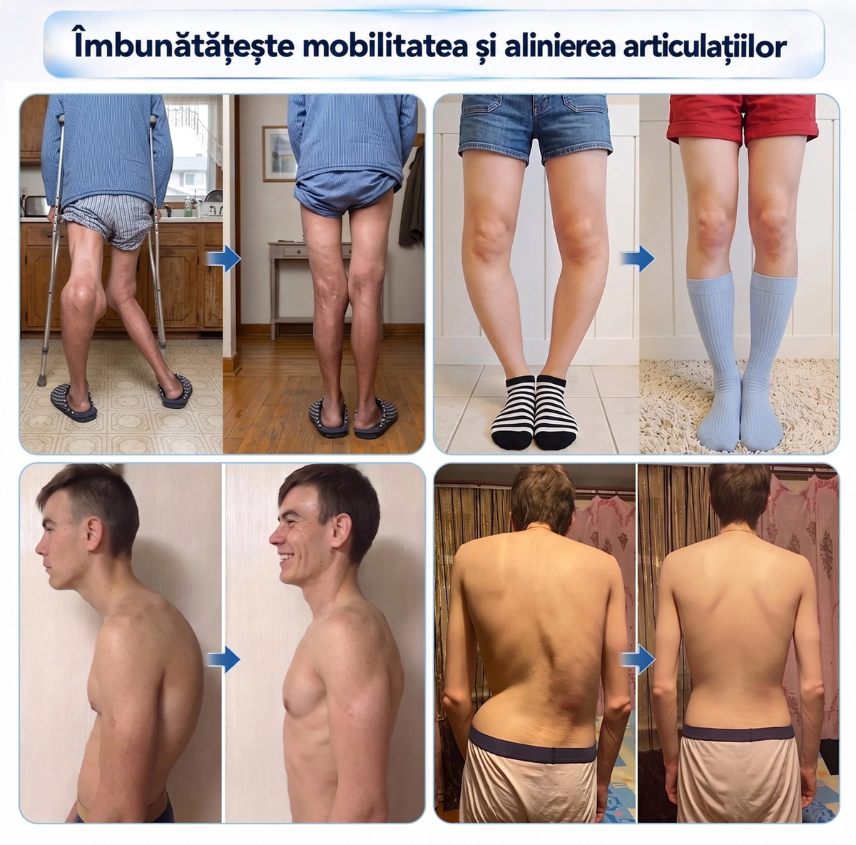 🌿𝑿𝑹𝑳𝑿𝑹𝑳®👨‍⚕️ TEHNOLOGIE ORTOPEDICĂ DE NOUĂ GENERAȚIE Rulou regenerant pentru oase și articulații cu microace de 0,05 mm